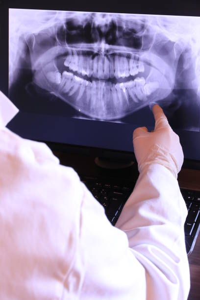 Best Emergency Treatment for Dental Infections or Abscesses in Hrison, AR