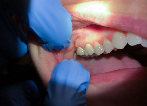 Best Emergency TMJ Treatment in Hrison, AR