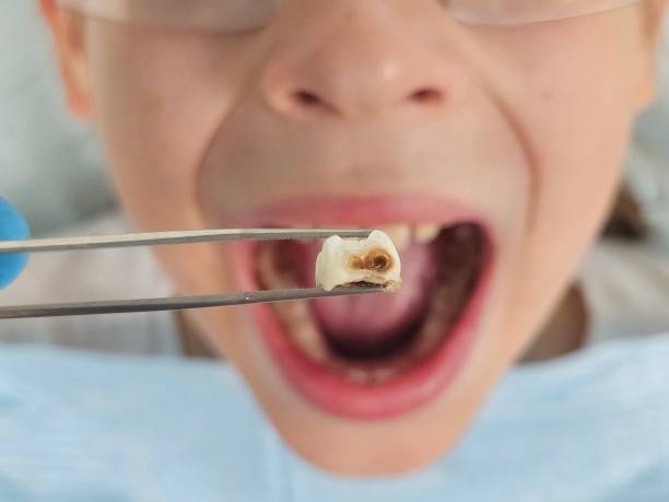 Best Weekend Emergency Dentist in Hrison, AR