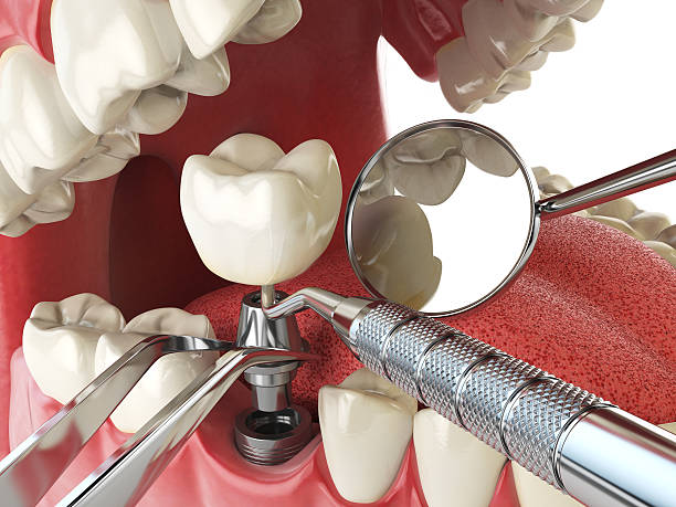 Best Emergency Wisdom Teeth Removal in Hrison, AR